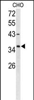 1 - FOXL1 Antibody (Center) AP9211c