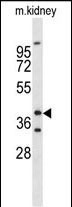 1 - FOXL1 Antibody (Center) AP9211c