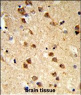 14 - ATXN3 Antibody (Center) AP9244c