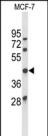 1 - ATXN3 Antibody (Center) AP9244c