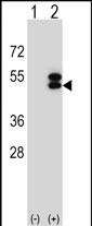 1 - ATXN3 Antibody (Center) AP9244c