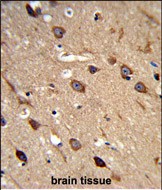 14 - ACCN2 Antibody (C-term) AP9270b