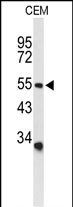 1 - ACCN2 Antibody (C-term) AP9270b