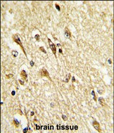 14 - MOUSE VGLU2 Antibody (C-term) AP9300b