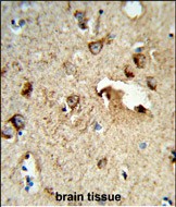 14 - TSPAN1 Antibody (Center) AP8693c