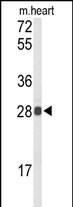 1 - TSPAN1 Antibody (Center) AP8693c