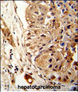 14 - ATLA2 Antibody (Center) AP9367c