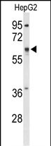 1 - ATLA2 Antibody (Center) AP9367c