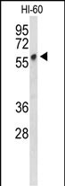 1 - PLVAP Antibody (Center) AP9378c