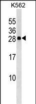 1 - CXXC4 Antibody (C-term) AP9385b
