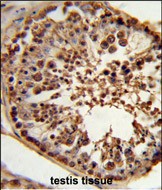 14 - CSPP1 Antibody (N-term) AP9386a