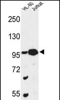 1 - CSPP1 Antibody (N-term) AP9386a