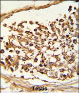 14 - JMJD2B Antibody (N-term) AP9393A