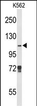 1 - JMJD2B Antibody (N-term) AP9393A