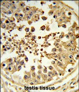 14 - DIAPH2 Antibody (Center) AP9407c