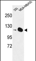1 - DIAPH2 Antibody (Center) AP9407c