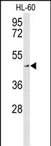 1 - SLC1A5 Antibody (Center) AP9437c