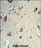 14 - HS3ST2 Antibody (C-term) AP9513B