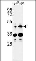 1 - HS3ST2 Antibody (C-term) AP9513B