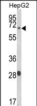 1 - WAC Antibody (Center) AP9537C