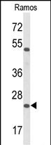 1 - FAM54B Antibody (C-term) AP9541a