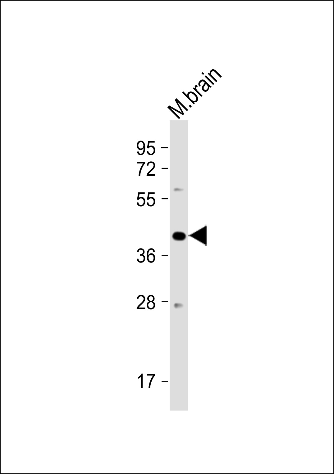 1 - PSG3 Antibody (N-term) AP9558c