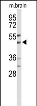 1 - WIPI2 Antibody (C-term) AP9559b