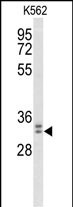 1 - MORG1 Antibody (Center) AP9575c