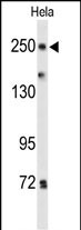 1 - PTPRD Antibody (N-term) AP9589A
