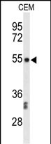 1 - CENPI Antibody (Center) AP9618c