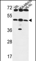 1 - B3GNT5 Antibody (Center) AP9649c