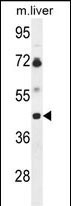 1 - B3GNT5 Antibody (Center) AP9649c