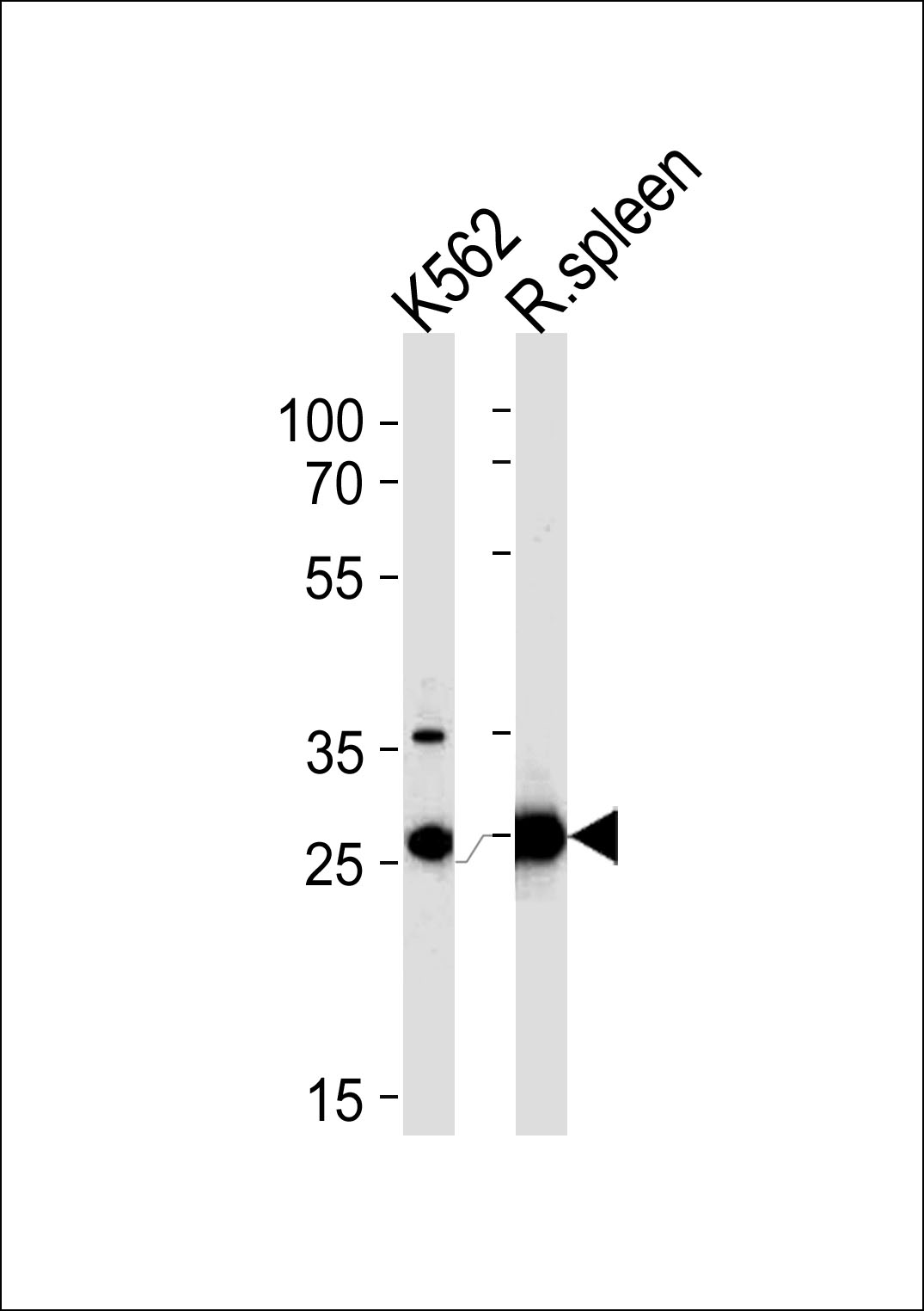 1 - SLC25A37 Antibody (C-term) AP9715b