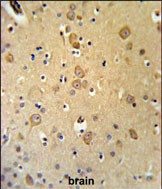14 - LRRTM1 Antibody (Center) AP9720c