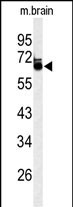 1 - LRRTM1 Antibody (Center) AP9720c