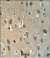 14 - UPK1B Antibody (Center) AP9725c