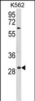 1 - UPK1B Antibody (Center) AP9725c