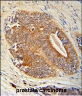14 - GAGE7 Antibody (C-term) AP9756b