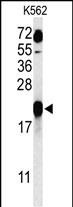 1 - GAGE7 Antibody (C-term) AP9756b