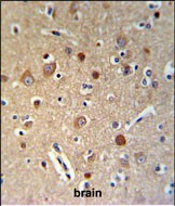 14 - HSPA12A Antibody (Center) AP9765c
