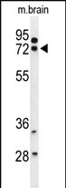 1 - HSPA12A Antibody (Center) AP9765c