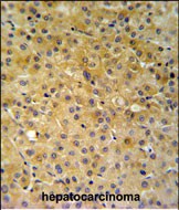 14 - NDUFA10 Antibody (Center) AP9768c
