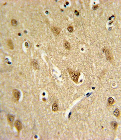 14 - ST8SIA4 Antibody (Center) AP9771C