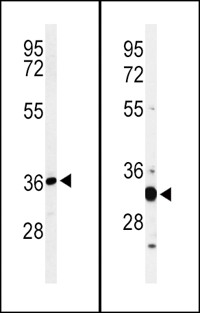 1 - ST8SIA4 Antibody (Center) AP9771C