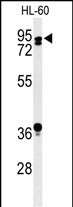 1 - PATL1 Antibody (C-term) AP9796b