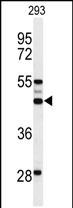 1 - OST alpha Antibody (C-term) AP9838b