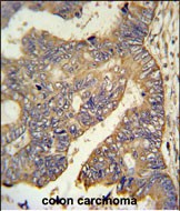 14 - PAR6G Antibody (N-term) AP4750A