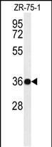 1 - PAR6G Antibody (N-term) AP4750A