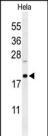 1 - CLEC2B Antibody (Center) AP4770c