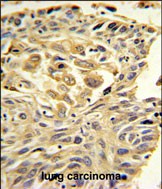 14 - ZO1 Antibody (C-term) AP4783b